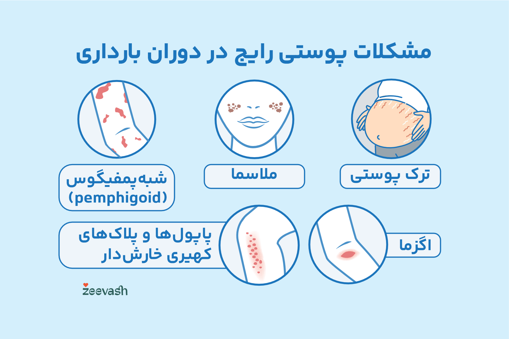 مشکلات پوستی دوران بارداری